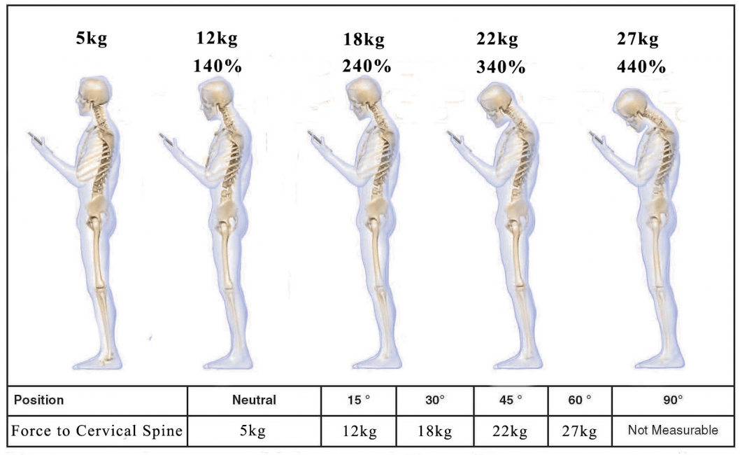Slipped disc cyriaxphysio