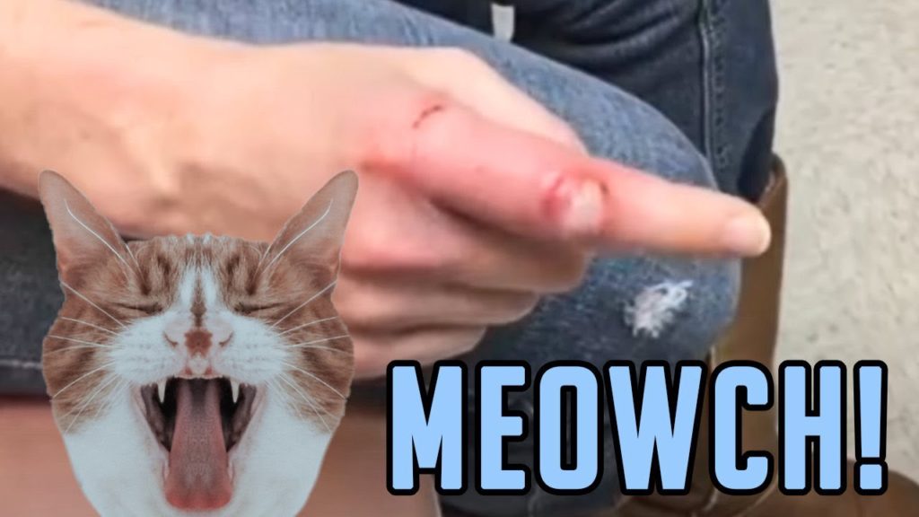 Cellulitis Double Feature Cat Bite vs Cyst Pimple Popping Videos