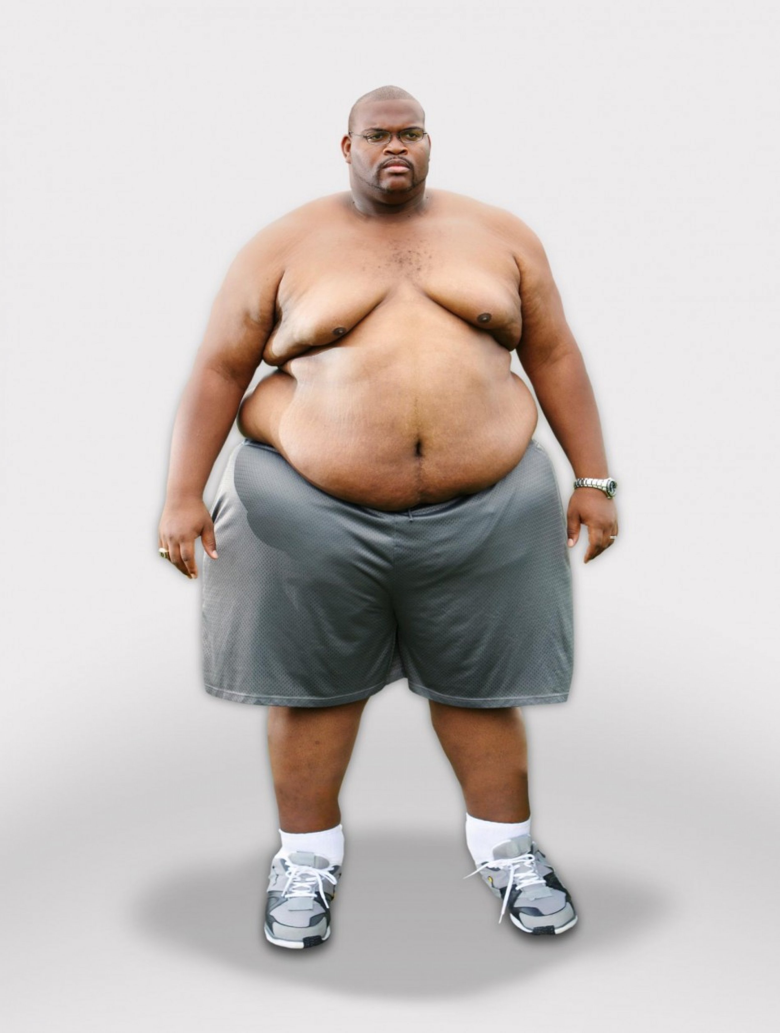 Extreme Makeover Weight Loss Logo