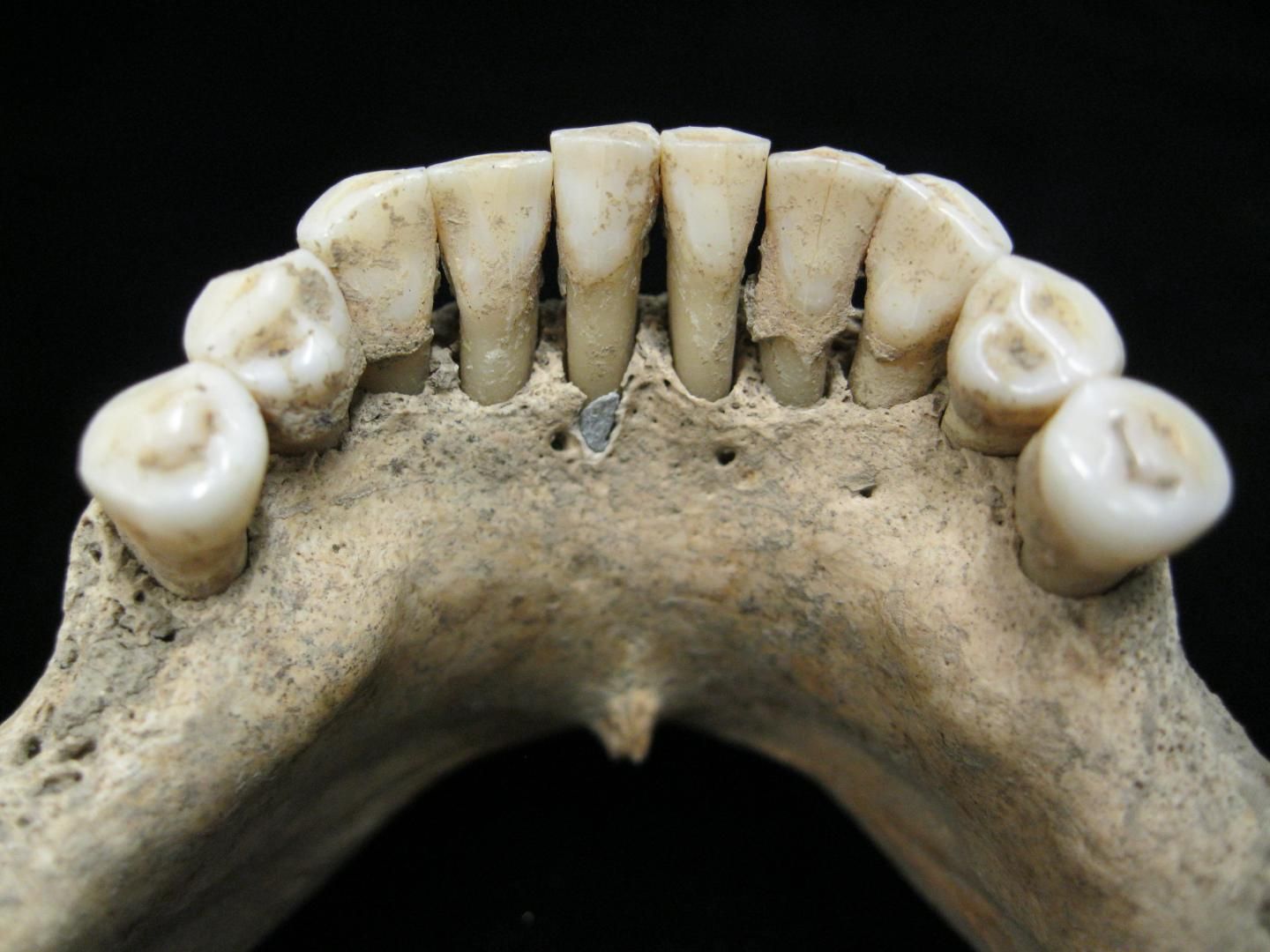 How Did Medieval People Brush Their Teeth TeethWalls