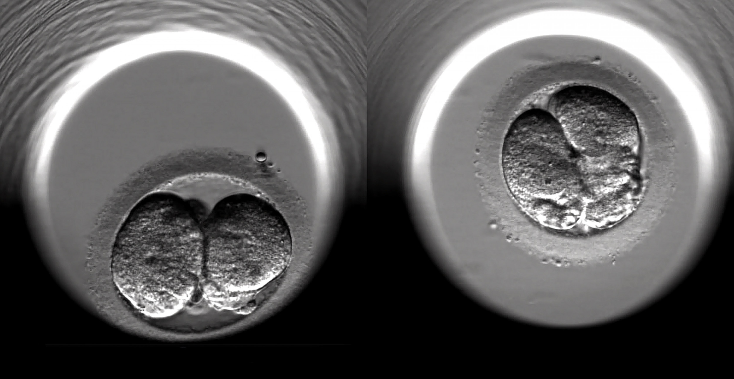 Fertility Preservation Bill Would Give Insurance Coverage to Cancer