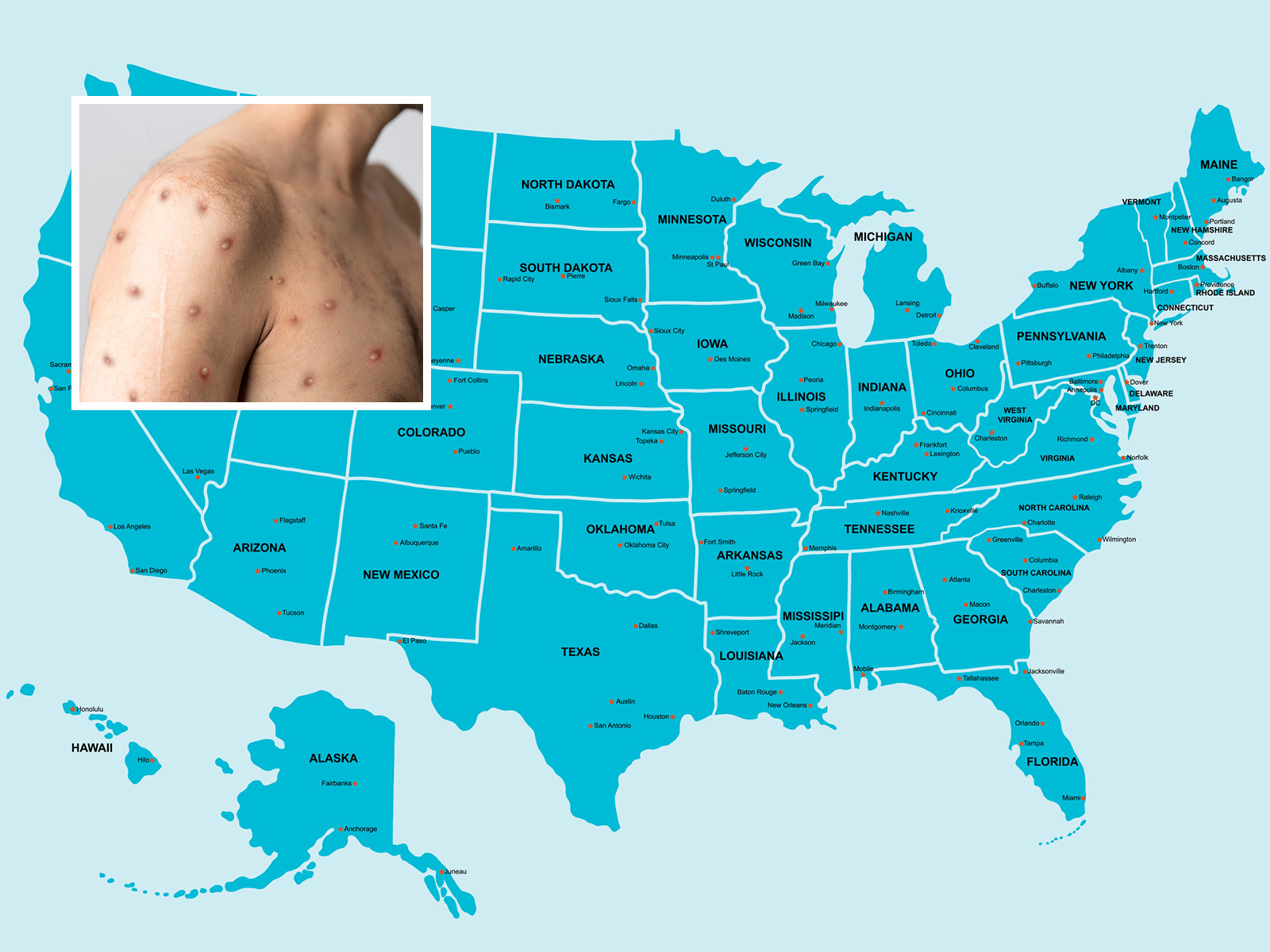 Diagnosis, control and eradication of American foulbrood disease