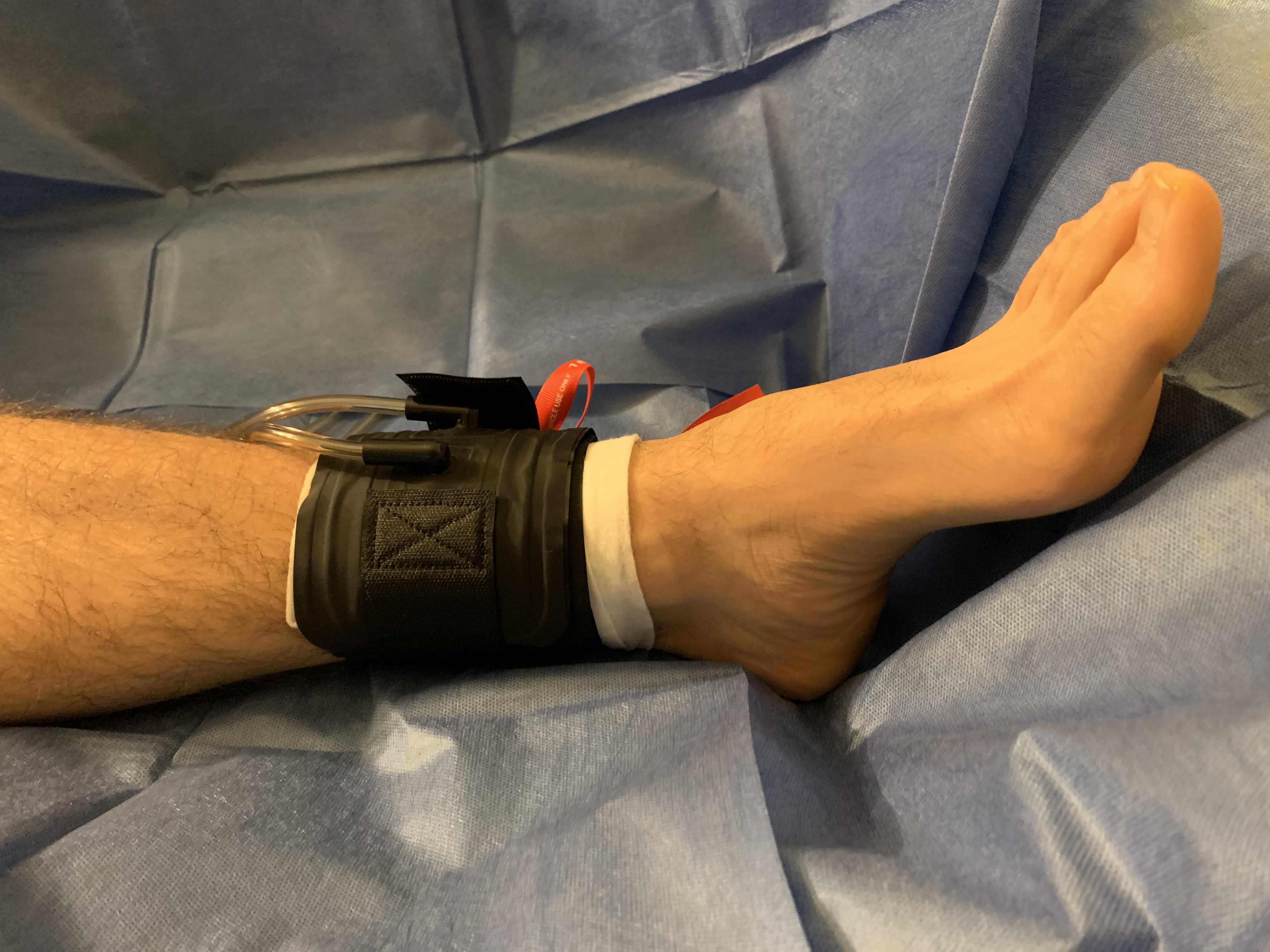 Volume 34 Issue 4 April 2021 Podiatry Today