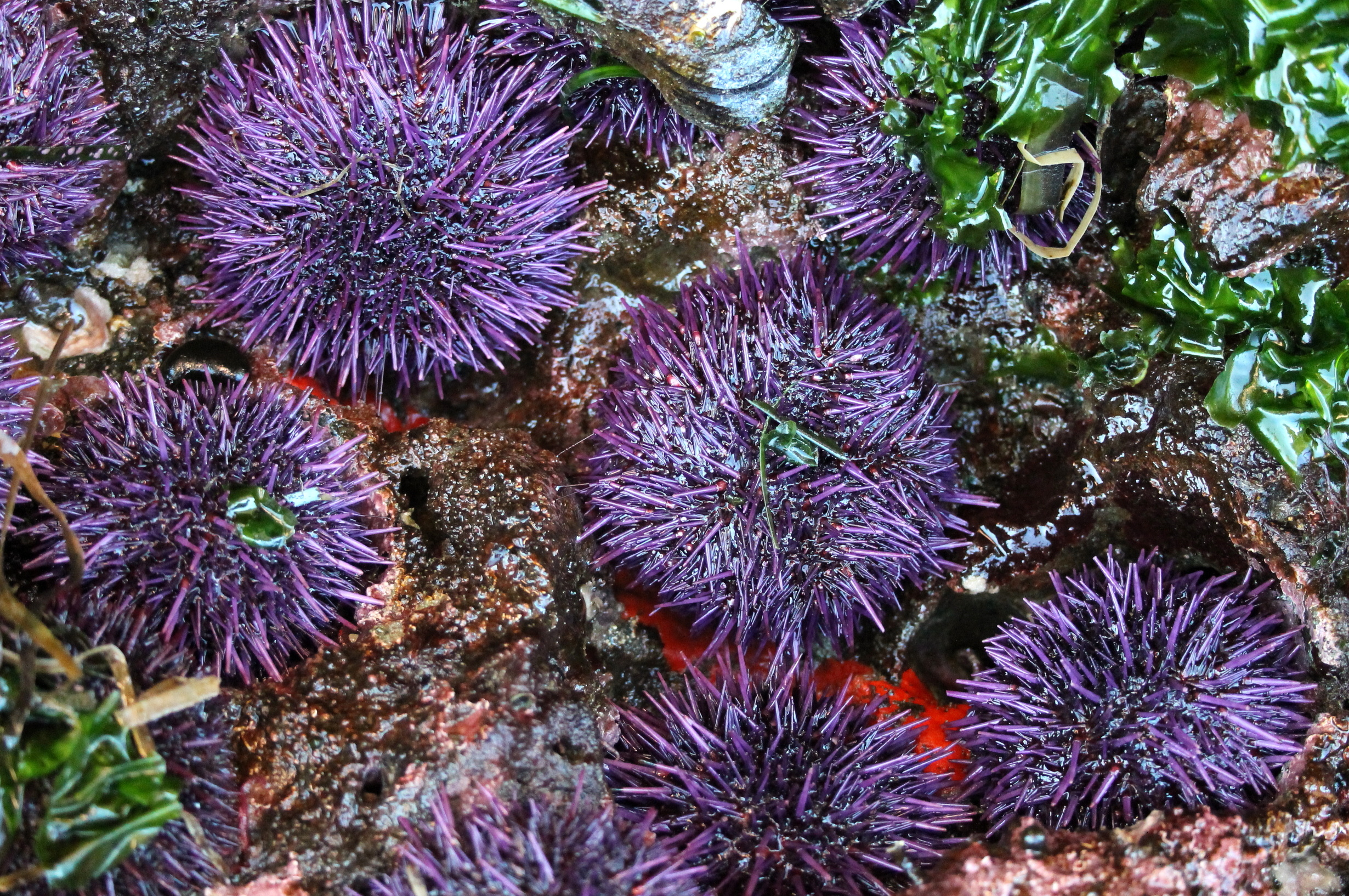 Sea Urchin Stuck In Foot