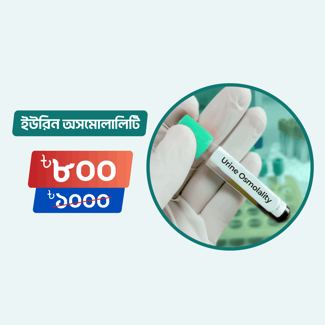 Urine Osmolality Arogga Online Lab