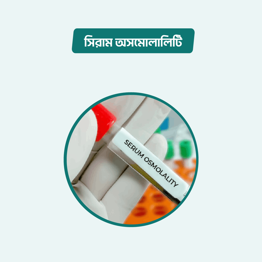 Serum Osmolality Arogga Online Lab