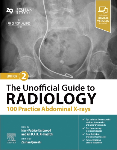 The Unofficial Guide to Radiology 100 Practice Abdominal Xrays