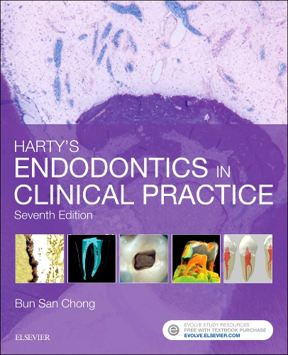 Endodontics Edition 1 By Mahmoud Torabinejad, DMD, MSD, PhD, Ashraf