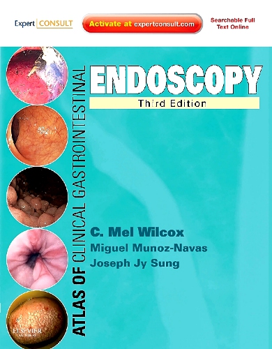 Atlas of Clinical Gastrointestinal Endoscopy Edition 3 By Charles