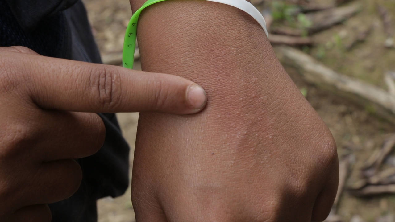 What Do We Know About How Oil Spills Affect Human Health? Not Enough. Amazon Frontlines