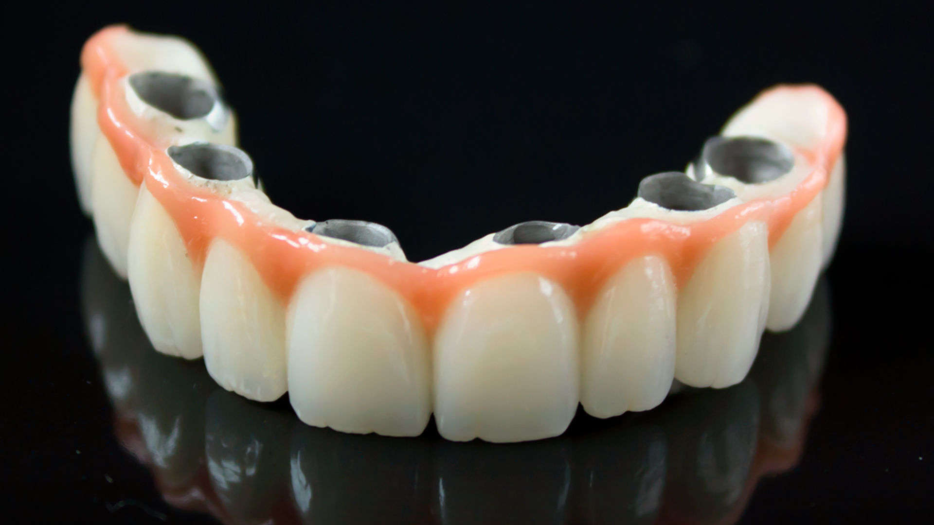 Masterclass Distribución de implantes para prótesis dentales