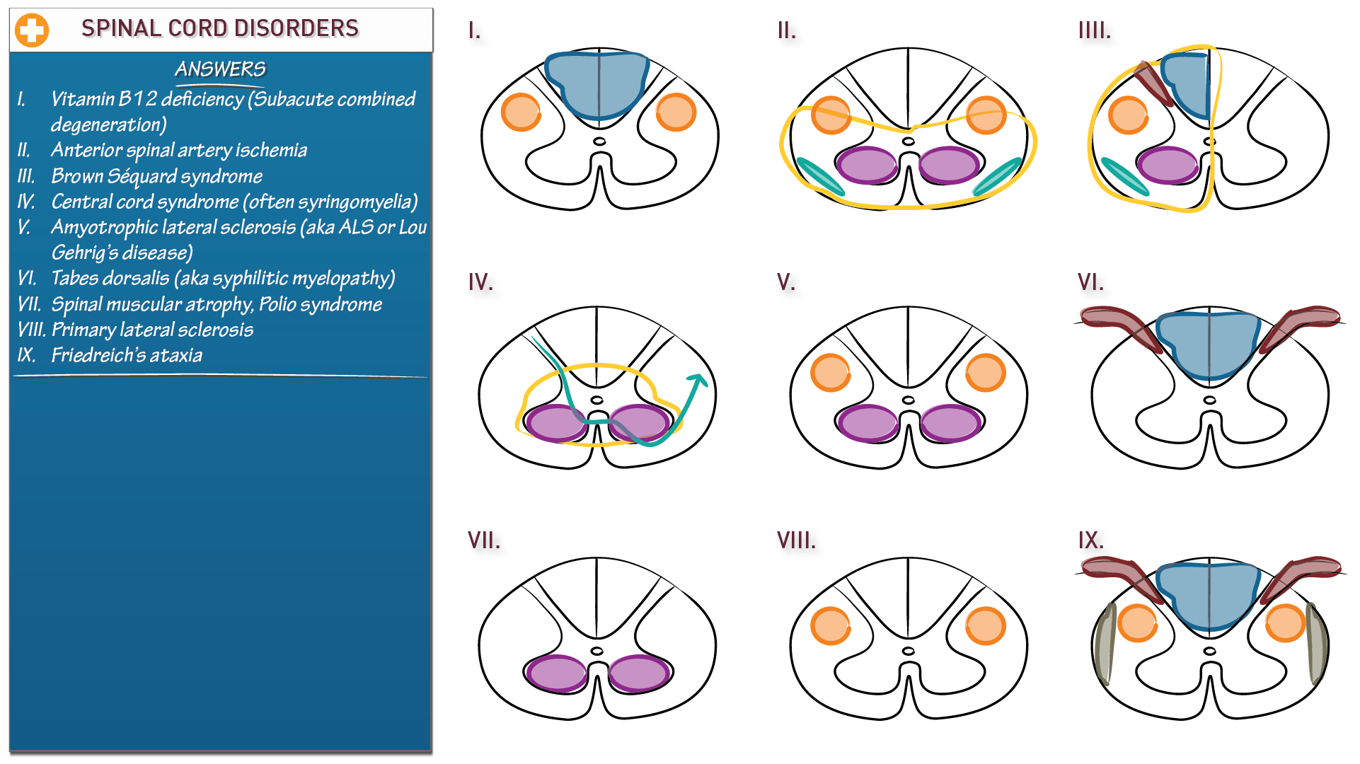 Neuroanatomy Spinal Cord Disorders ditki medical & biological sciences