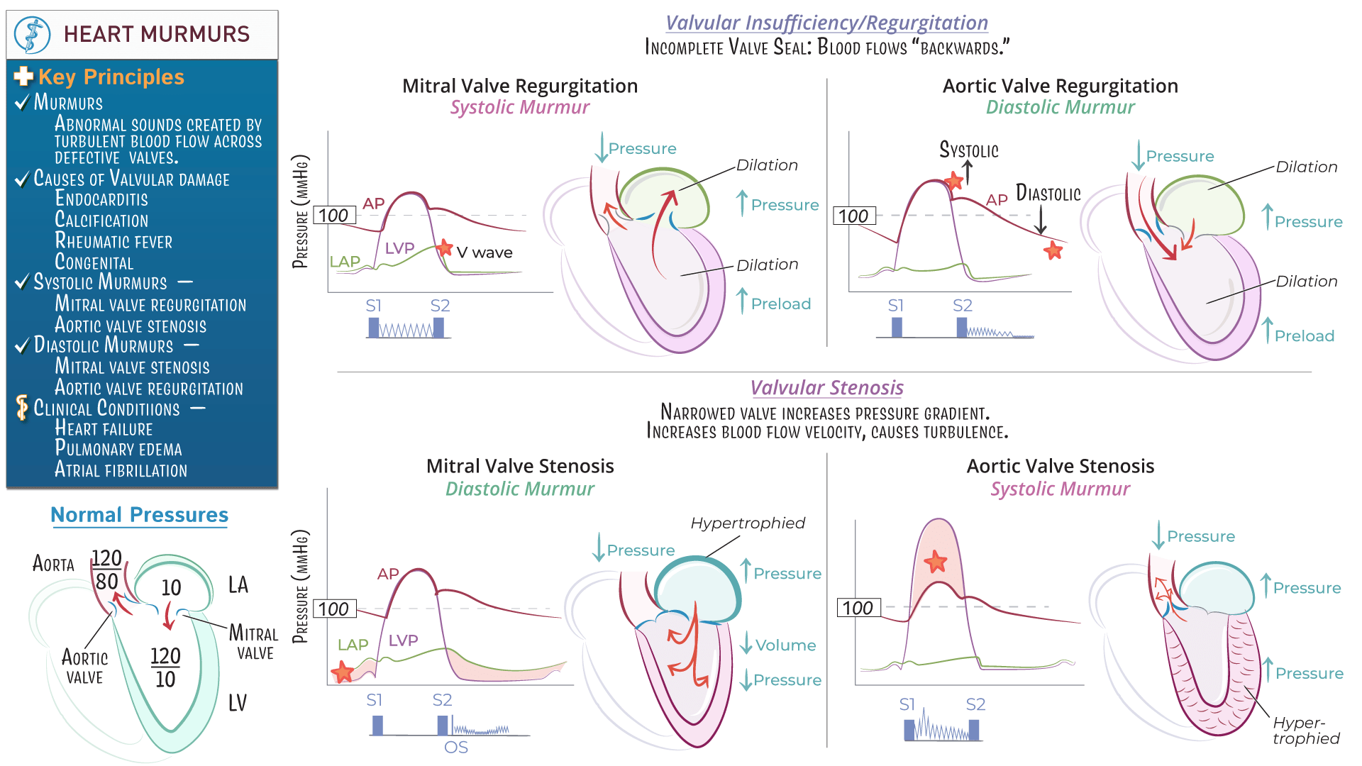 Physiology Heart Murmurs (Stenosis & Regurgitation) ditki medical