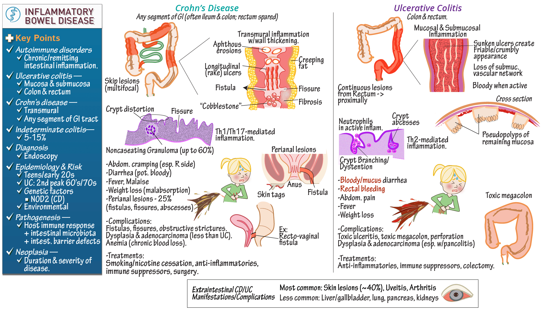 Clinical Pathology Inflammatory Bowel Disease (Ulcerative colitis