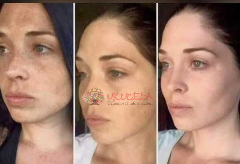 face wash 180 crema para las manchas Ukucela