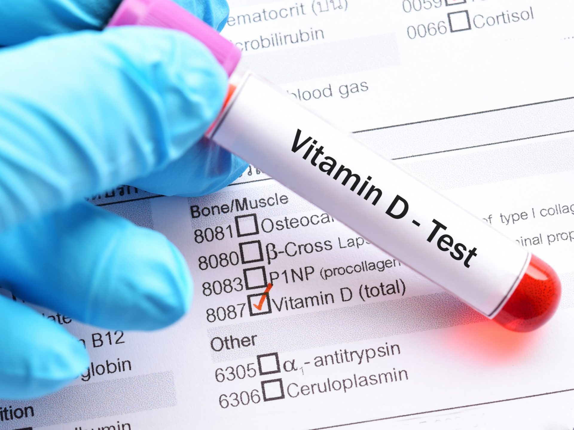 Unraveling the Hidden Benefits of Vitamin D A Blood Test You Need Now
