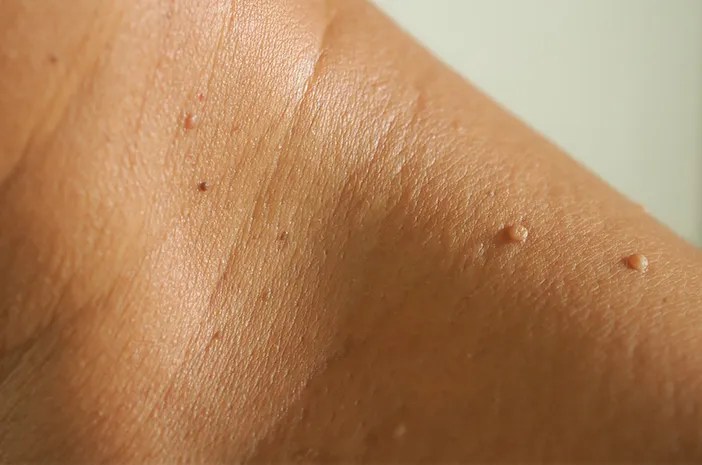 Skin
