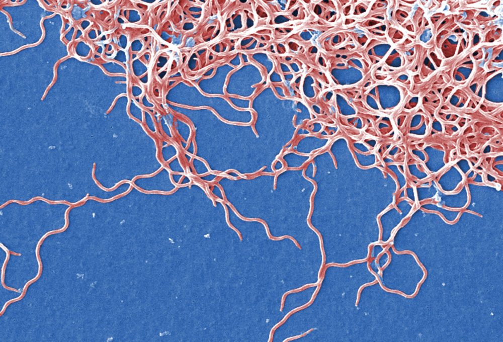 Our Dogs Can Get Lyme Vaccines And We (Still) Can't. When Might We