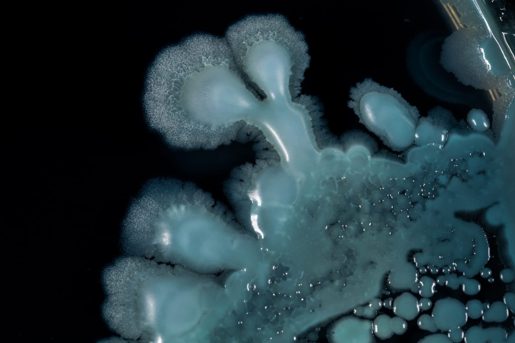 From Blue Cheese To Dirt, How Beautiful Bacteria Can Be CommonHealth