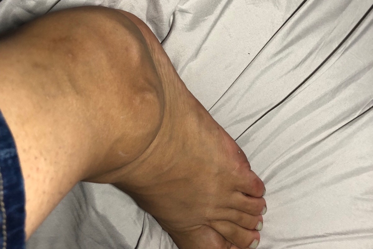 Fundraiser by Nayelly Gonzalez Medical expenses for Nayelly’s amputation