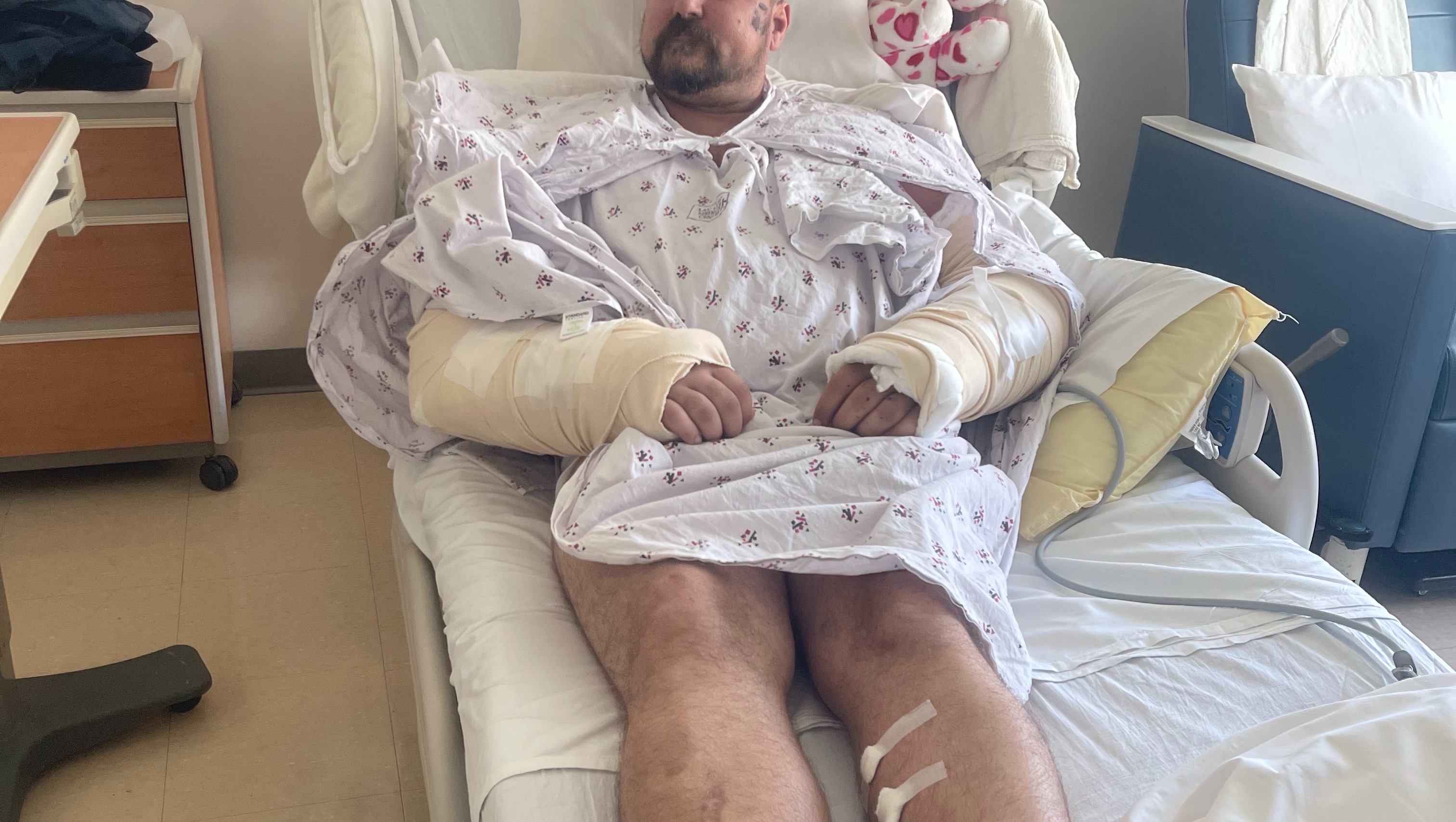 Fundraiser By Eric Smith Scooter Accident