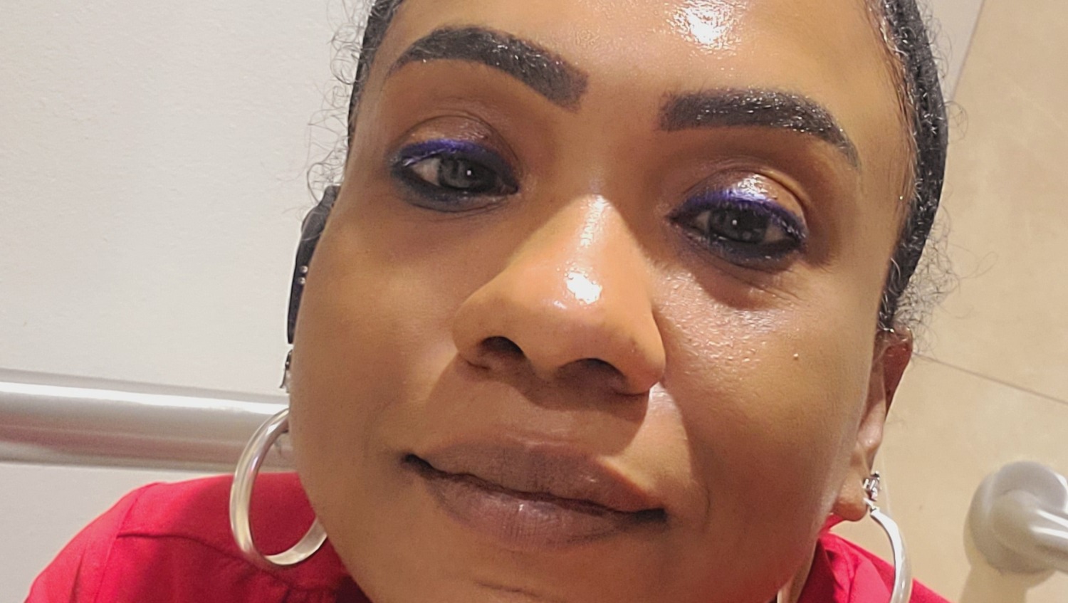 Fundraiser by Nadine Campbell Double Knee Replacement Surgery