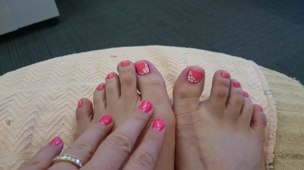 Healthy Nails Salon Offers Callus Removal in Laguna Niguel, CA 92677