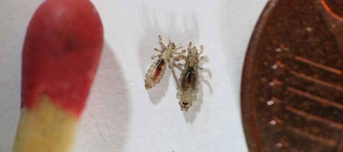 Head Lice Patrol Offers Head Lice Treatments in Carlsbad, CA 92008