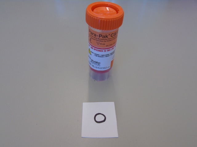 Clostridium difficile Toxin Torrance Memorial Laboratories