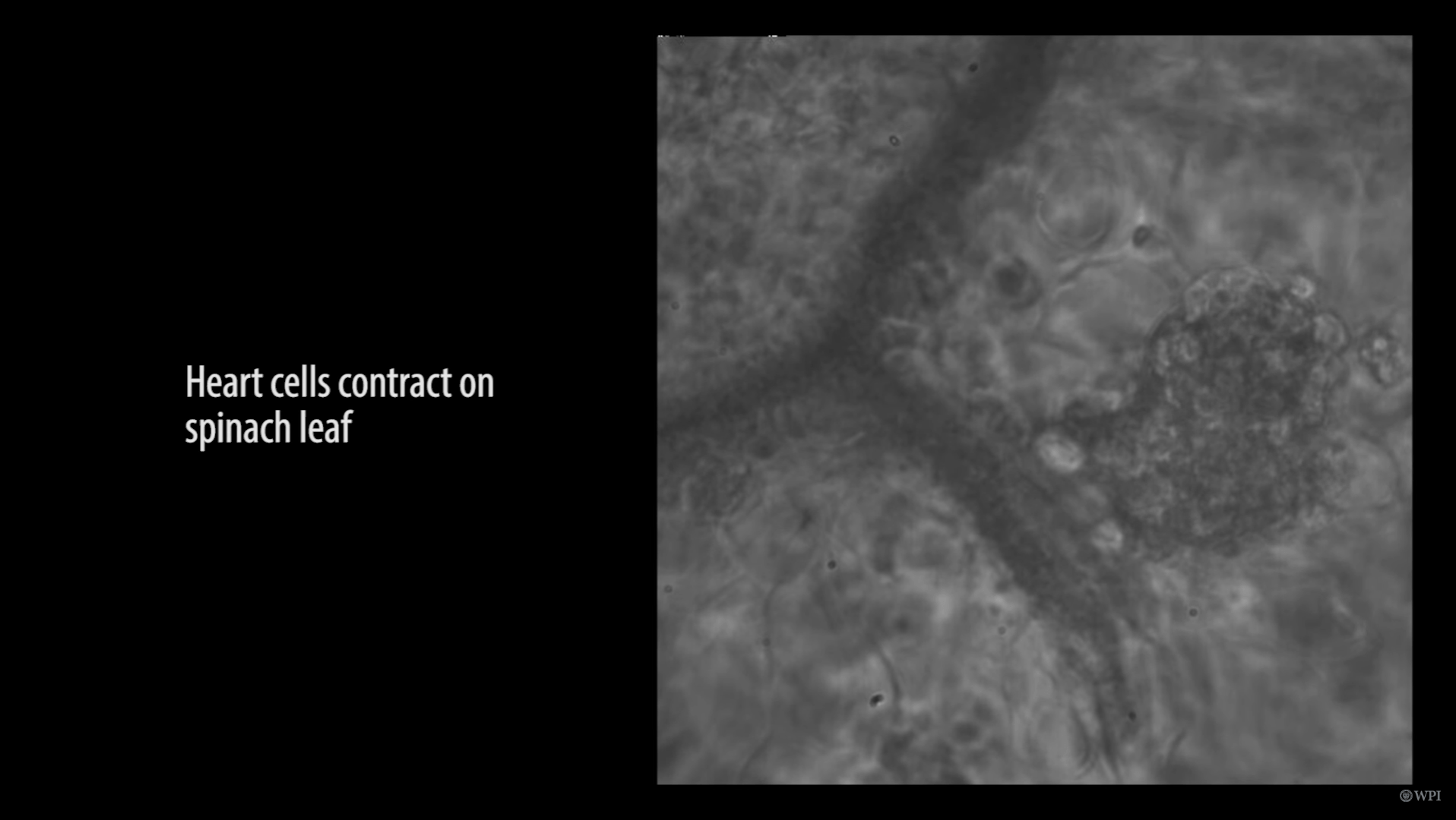 Awesome Alert Scientists Find Way To Grow Human Heart Tissue Using