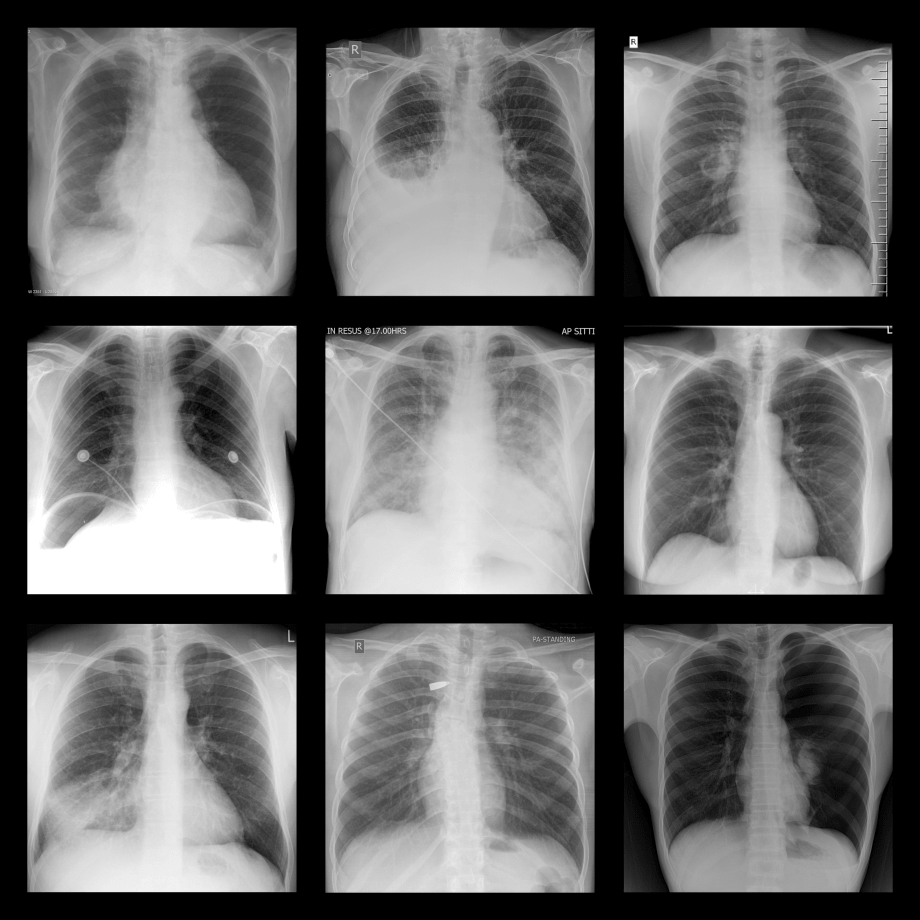 (Chest) XRay Vision! Quiz By Alcas