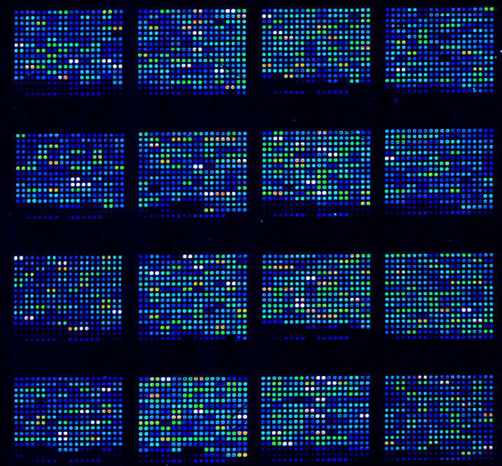 Bioinformatics at Carleton