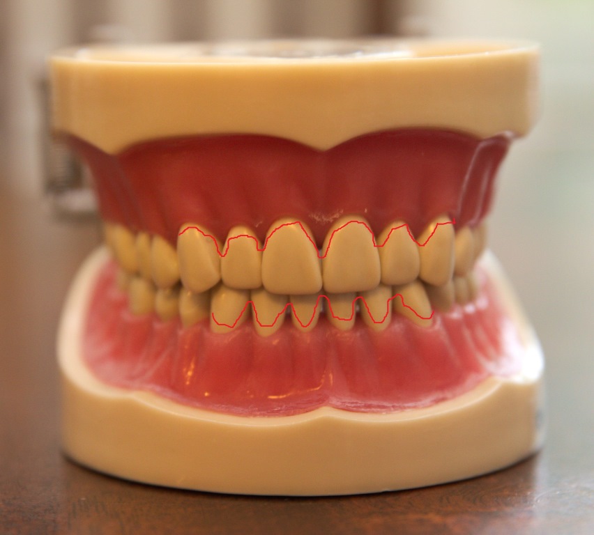 Clean Your Own Teeth In Between Dental Visits The Healthy Mouth Project