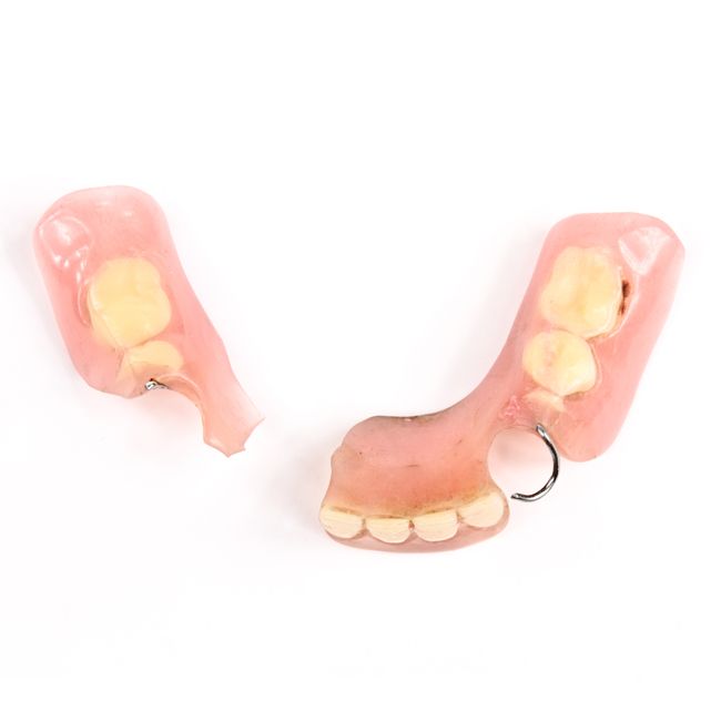 Signs Your Dentures Need to Be Replaced Redwood City, CA