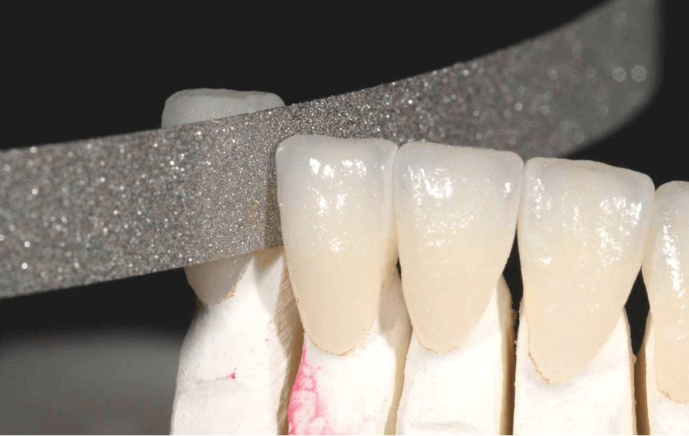 NTI Diamond Finishing Strips Prestige Dental