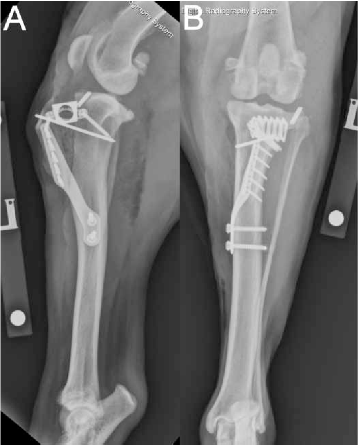 Figure 5 from Tibial tuberosity transpositionadvancement for treatment