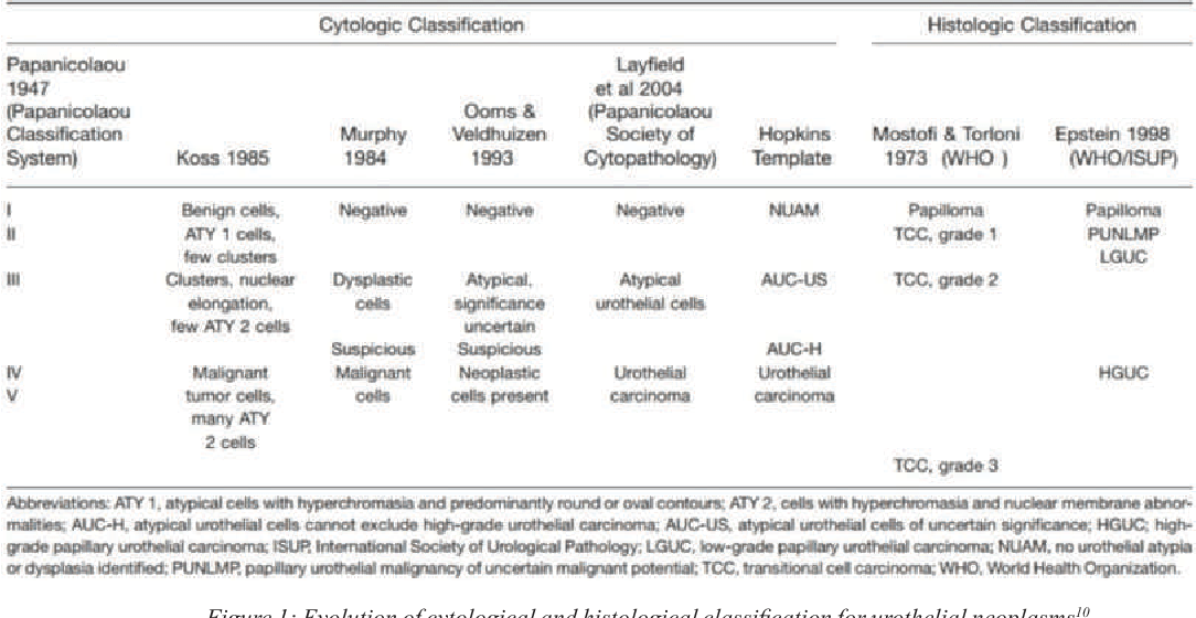 [PDF] The Paris System A new insight into reporting urine cytology