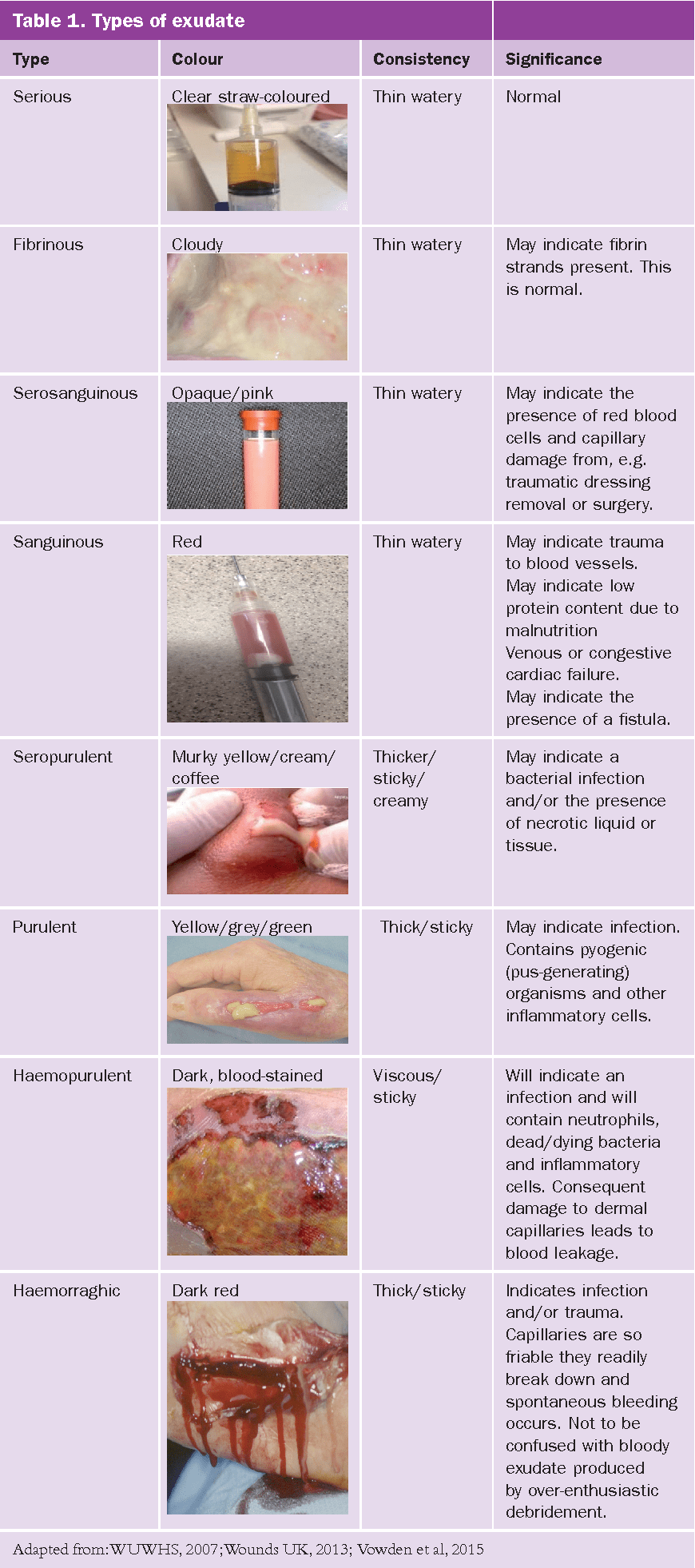 Wound exudate assessment and management a challenge for clinicans