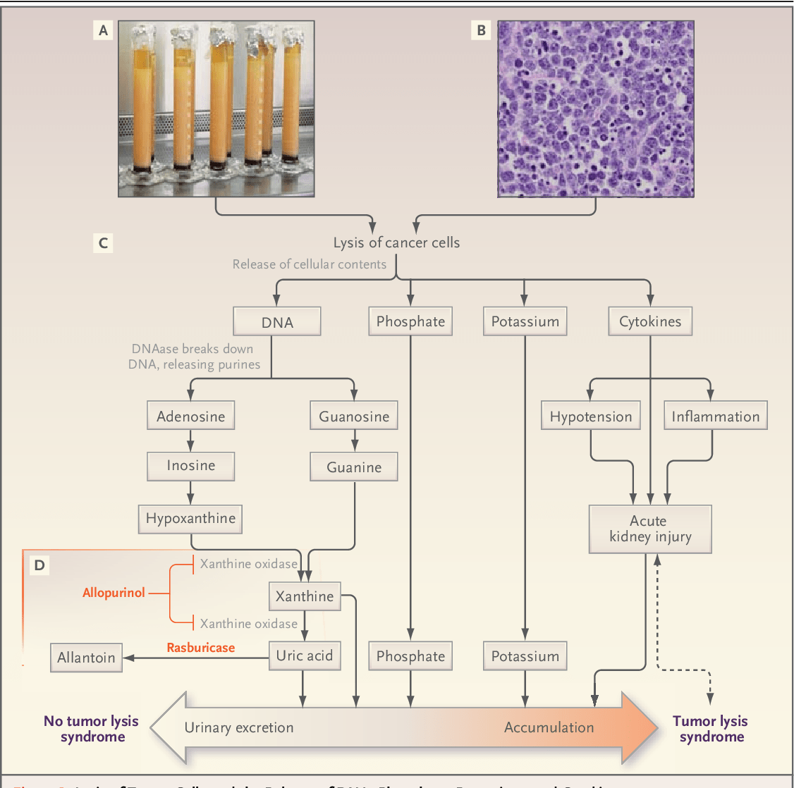 [PDF] The tumor lysis syndrome. Semantic Scholar