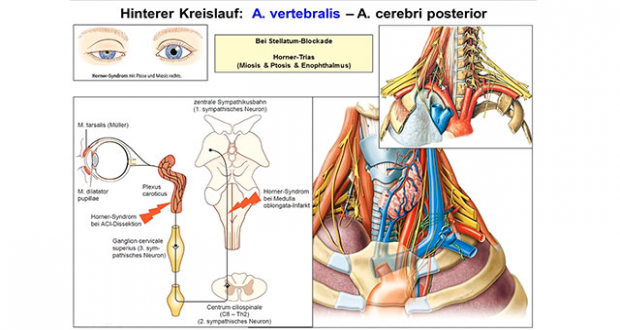 Arterien im KopfHalsBereich Online Lernen mit Lecturio