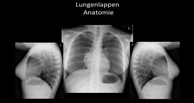 Radiologie des Thorax Online Lernen mit Lecturio