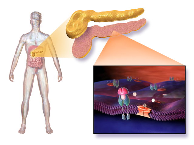 Types of Diabetes Type 1, Type 2 and Type 3 and Gestational Diabetes