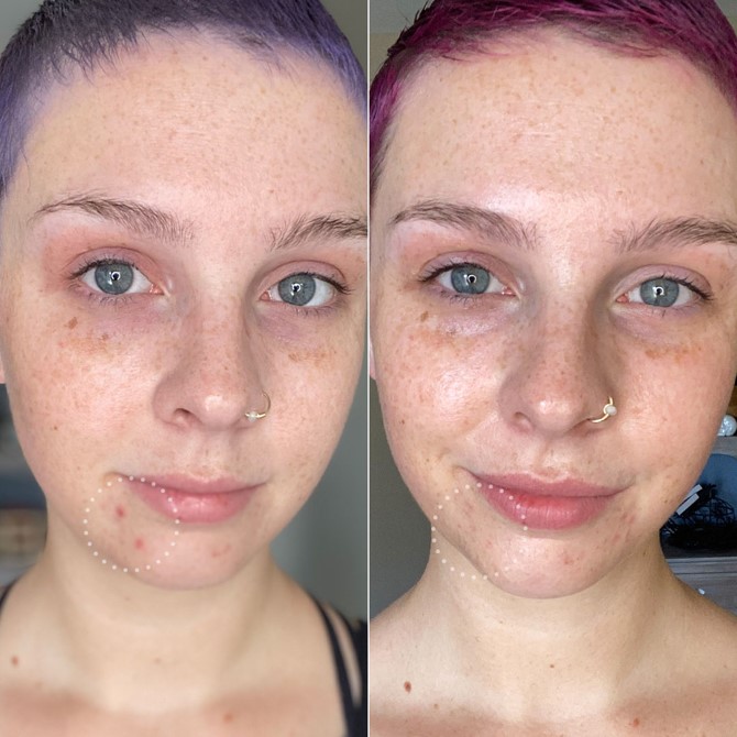 Hero Cosmetics Lightning Wand Mini Free Samples, Reviews PINCHme