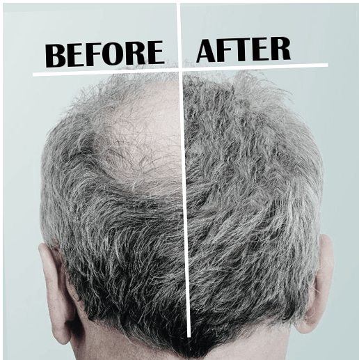 Hair Therapy Shampoo Special Offer