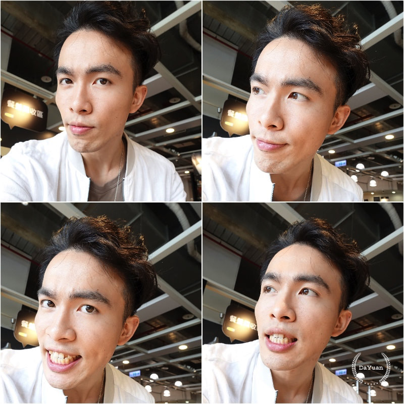 牙齒矯正｜SOV舒服美 關於隱形牙套，你可能想知道的事（1）