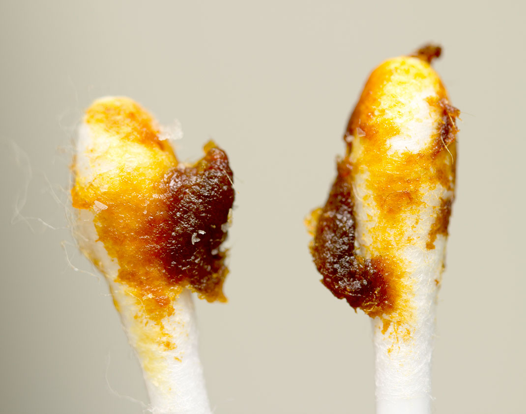 De ses origines à son extraction, percez à jour les mystères du cérumen