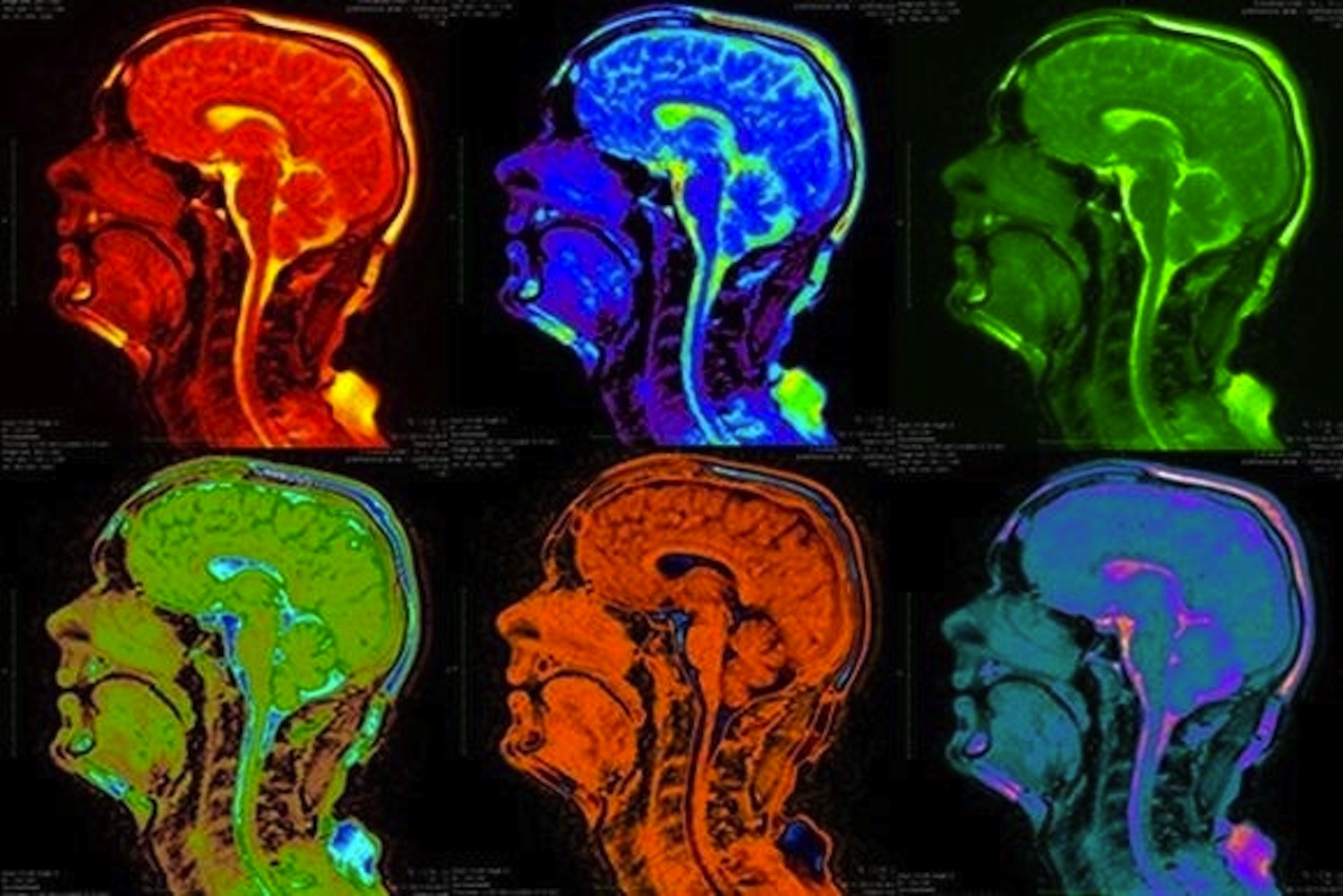 Study Shows Science Behind Music Addiction