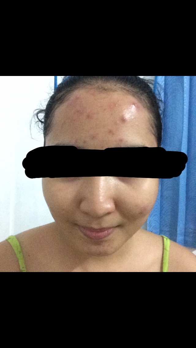 REVIEW DR. SUTARDI SpKK hari ke4 Dancing on Savanna