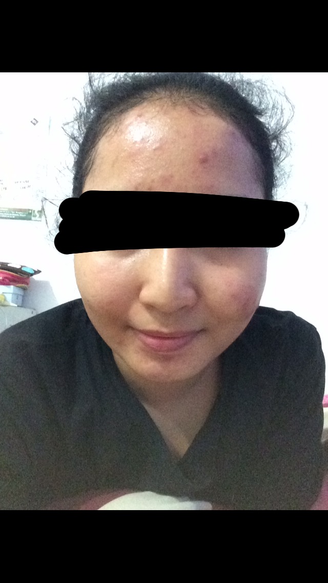 REVIEW DR. SUTARDI SpKK hari ke4 Dancing on Savanna