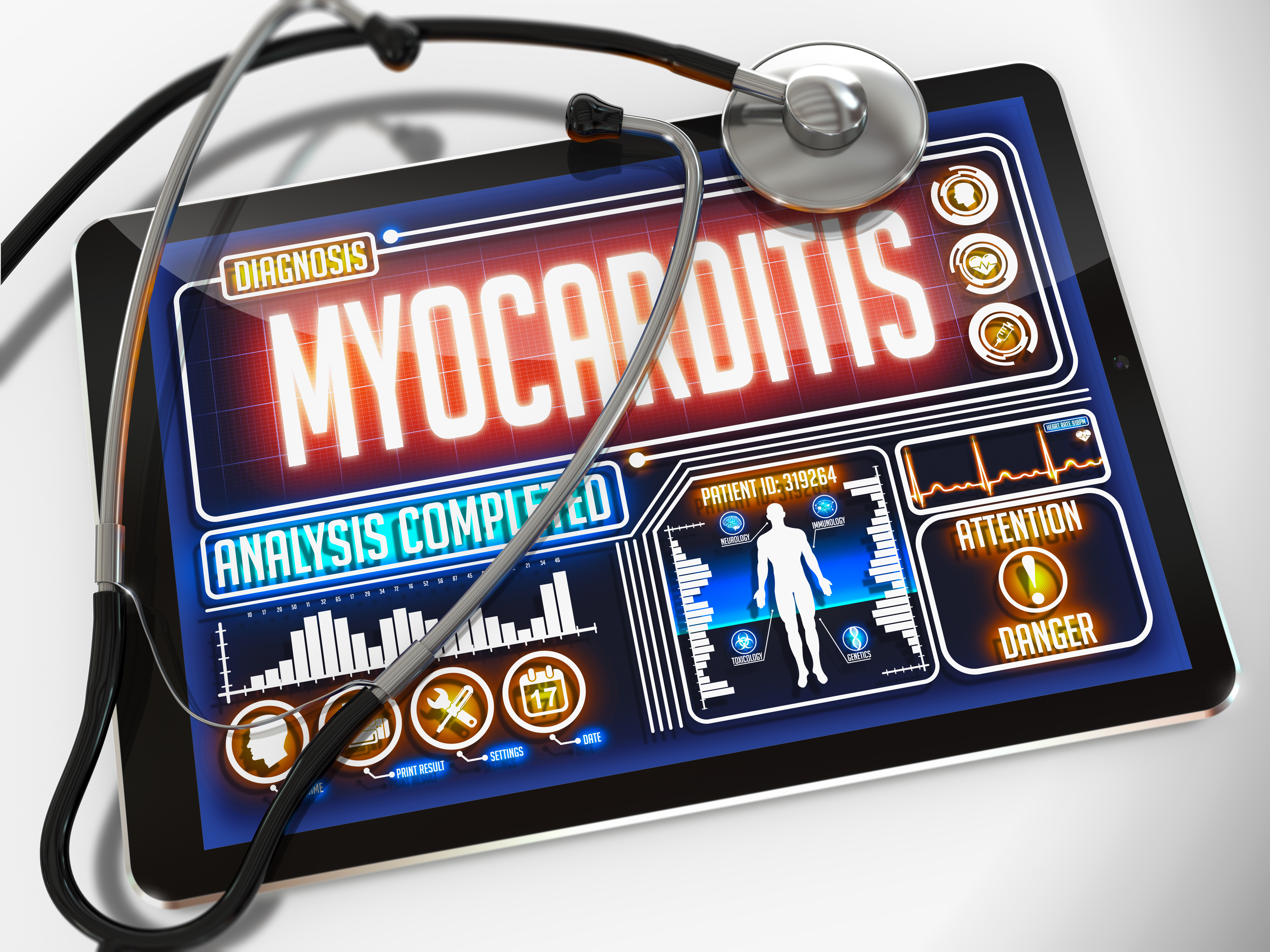 How Lyme myocarditis might present in an adolescent patient Daniel